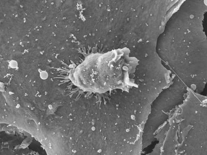 צילום במיקרוסקופ אלקטרונים סורק של תא דם לבן שולח רגליים חודרניות, הננעצות בתאי אנדותל. נעיצת הרגליים נעשית תוך כדי זחילה, תחת זרם הדם